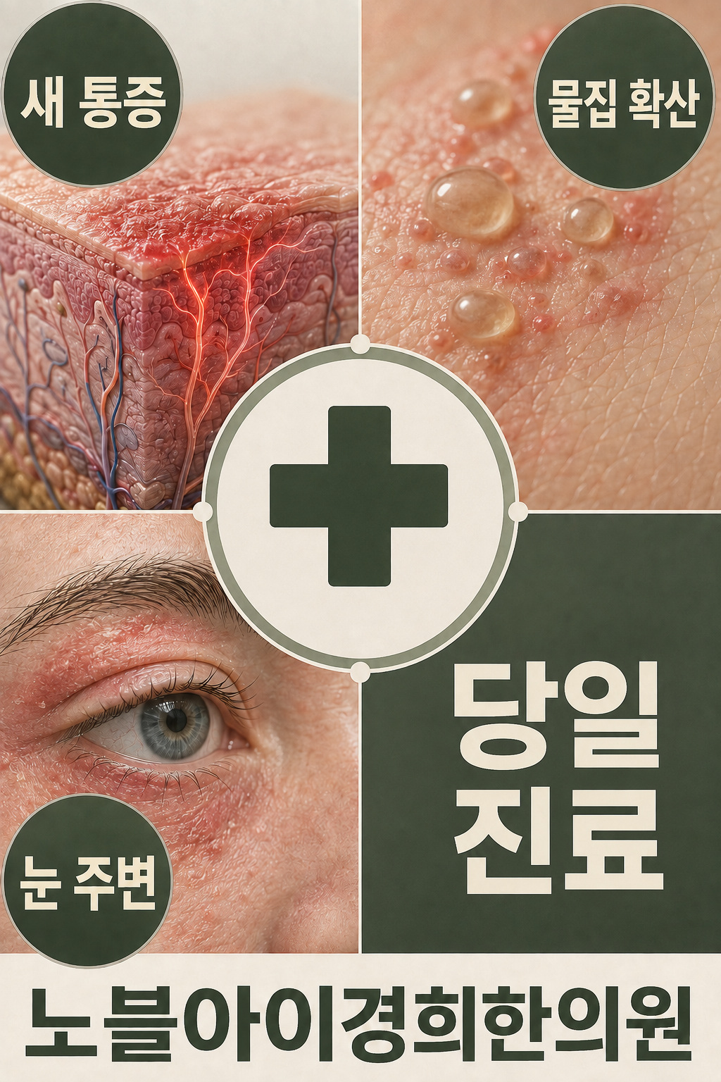 새 통증과 물집 확산 및 눈 주변의 변화는 당일 진료가 필요한 신호임을 설명하는 도식