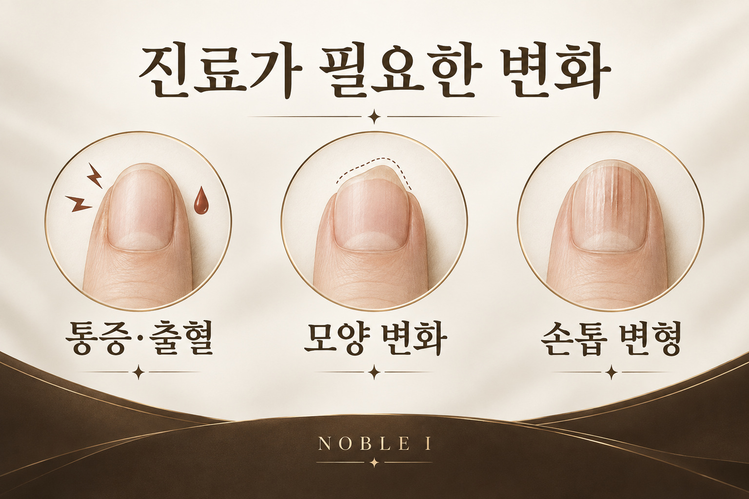 통증·출혈과 모양·손톱 변형을 살피는 인포그래픽