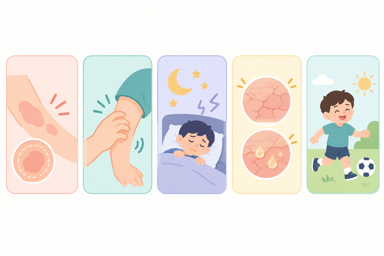 아토피의 붉음과 가려움·수면·진물·통증을 서로 다른 평가축으로 보여 주는 인포그래픽